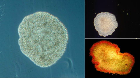 three images of roundish placozoans