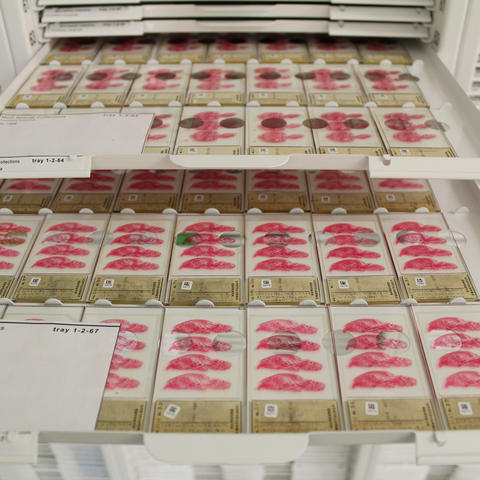 two drawers containing microscope slides